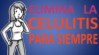 Como Eliminar la Celulitis de las Piernas y Gluteos [upl. by Hertzog]