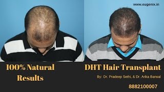 Hair transplant Surgery in India at Eugenix Hair Transplant Sciences [upl. by Ayot]