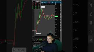 Mastering Trading Stop Loss Strategies You Must Know [upl. by Ellerred455]