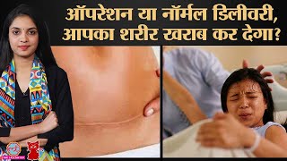 C Section Delivery से बच्चा बीमार पैदा होता है डॉक्टर ने सारे myth दूर कर दिए  Meow  Ep181 [upl. by Schmidt]