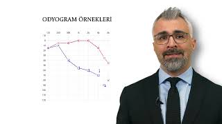 İşitme Cihazı Modeli Tercih Edilirken Dikkat Edilmesi Gerekenler [upl. by Kelbee]