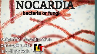 Nocardia ।। IntroductionScientific Classification Pathogenesis Laboratory Diagnosis of Nocardia [upl. by Aliuqet]