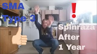 Spinraza Before 6 months and after 1 year [upl. by Eltrym]