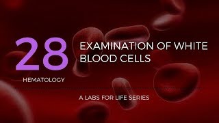 WHITE CELLS DISORDERS lecture 4 NEOPLASTIC PROLIFERATIONS general classification with LYMPH NODE str [upl. by Danna309]