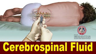 What is Cerebrospinal Fluid [upl. by Einobe]