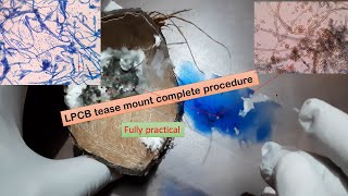 LPCB tease mount procedure and observation under the Microscope [upl. by Naicul448]