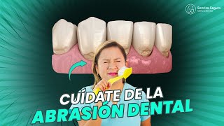 Cómo Prevenir y Tratar el Desgaste Dental 💡 [upl. by Zakarias383]