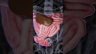 Understanding Small Bowel Perforation anatomy biology 3danimation [upl. by Okia]