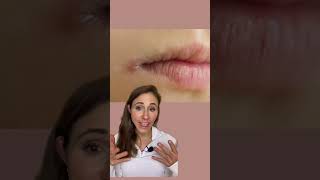 How To Get Rid Of Angular Cheilitis For Good dermatologist [upl. by Ettedo]