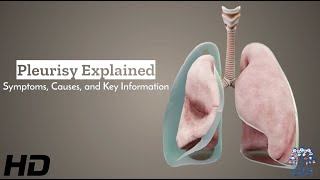 Pleurisy Unveiled Understanding Symptoms Causes and Vital Information [upl. by Gladi563]