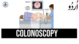 Colonoscopy Test in Urdu  What to Expect [upl. by Ariadne]