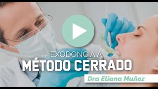 EXODONCIA A METODO CERRADO  Dra Eliana Muñoz [upl. by Aicenav]