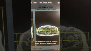 MRI Pelvis Scan mri medicalimaging radiology anatomy mrii science ivinsertion [upl. by Antsirhc44]