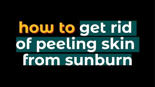 How to treat a Sunburn  Doctor Explains [upl. by Kessel]