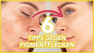 Pigmentflecken entfernen – die 6 BESTEN TIPPS gegen Hyperpigmentierung [upl. by Ydennek]