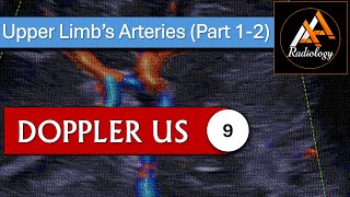 9  Upper Limbs Arteries Part 12 [upl. by Salvador]