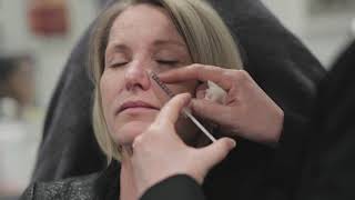 Beautiphi Clinic  Bunny lines treatment witth Botox [upl. by Goldfarb]