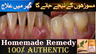 Gingival Recession Treatment at Home  Gums ka neechy jany ka ghr mn ilaj  Homemade Remedy ​⁠ [upl. by Rianna109]