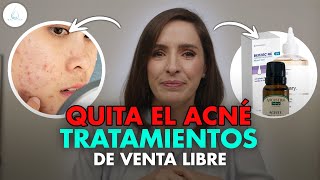 🔴 PRODUCTOS de SUPERMERCADO para TRATAR el ACNE ¿FUNCIONAN drapilarochoa  Dermatologa [upl. by Andris482]