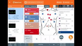 SimScope initial set up [upl. by Haliek]