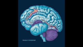 Understanding Fragile X Syndrome The Role of BabyMap [upl. by Ahsauqal]