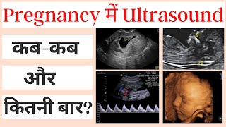 Pregnancy में अल्ट्रसाउंड कब और कितनी बार करना चाहिए  Sonography In Pregnancy [upl. by Innek]