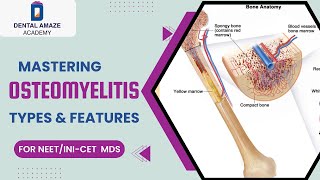 Mastering Osteomyelitis Types amp Features For NEETINICET MDS [upl. by Hsakaa]