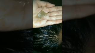 Powerful hair serum for Extreme hair growth 💪 viral shots [upl. by Ahsenak]