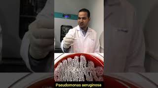 Oxidase test for Pseudomonas aeruginosa 🆚 Enterobacteriaceae شرح بالعربي إجراء اختبار الاوكسديز [upl. by Odranar494]