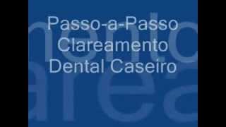 Clareamento dental com moldeira [upl. by Essilrahc]