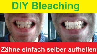 Zähne zu Hause selber bleichen  DIY Bleaching  Zähne aufhellen mit Backpulver [upl. by Nnylatsyrk]