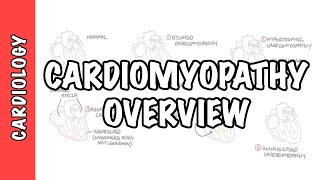 Cardiomyopathy Overview  types dilated hypertrophic restrictive pathophysiology and treatment [upl. by Ardnnaed460]