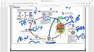 RS Micro  Paragonimus westermani and Echinococcus granulosus  Mutah [upl. by Buote]