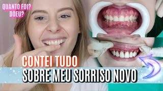 AUMENTEI MEUS DENTES doeu qual valor E MUITO MAIS [upl. by Setiram]