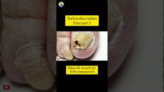 Terbinafine tablet Uses part 1 [upl. by Meir]