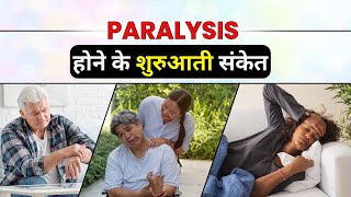 Paralysis लकवा होने के शुरुआती संकेत  Causes and symptoms of Paralysis  Bharat Homeopathy India [upl. by Lion]