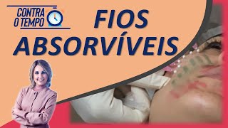 Fios Absorvíveis Descubra os tipos de fios existentes [upl. by Taimi]