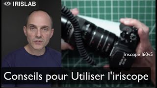 IRISLAB Iriscope I60v5  Conseils pour Utiliser liriscope [upl. by Oiludbo882]