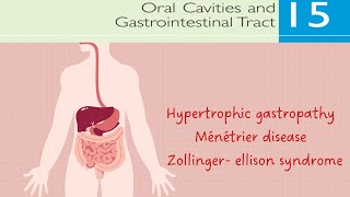 Hypertrophic gastropathy  Ménétrier disease  Zollinger ellison syndrome  Pathology  Lecture  5 [upl. by Beauchamp]