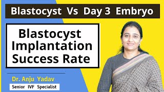 Blastocyst vs Day 3 Embryo l Blastocyst Implantation Success Rate l Dr Anju Yadav vedafertility [upl. by Niret]