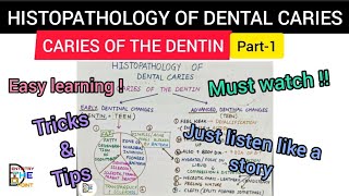 HISTOPATHOLOGY OF DENTAL CARIES  CARIES OF THE DENTIN PART1 [upl. by Byrn]