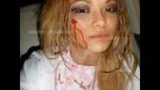 Tila Tequila Attacked at A insane clown posse Concert at The Gathering Of The Juggalos News [upl. by Odama]