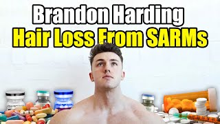 Brandon Harding Hair Loss From SARMs  RAD140 [upl. by Ardnalac]