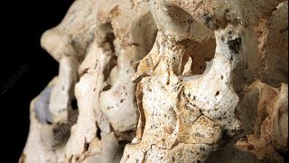 Unveiling the Neanderthal Connection How Ancient Genes Influence Autism Today [upl. by Aleck767]