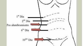 Puerperio Normal  Obstetricia  Clase 81 [upl. by Mullac]