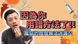 青春痘一直復發嗎！？改善，你必須這樣做！！【77老大】 [upl. by Amian848]