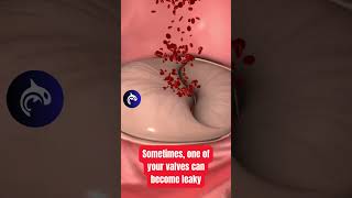 Do you have a leaky Heart Valve See how its fixed🫀 heartbeat anatomy medicalanimation [upl. by Chang]