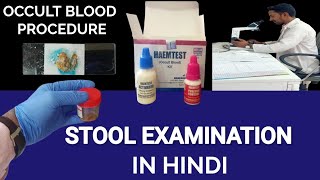 Stool Examination  Stool Microscopic Examination  माल की जांच  Stool Occult Blood Test [upl. by Harle]