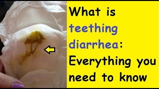 What is teething diarrhoea Everything you need to know [upl. by Hyrup]