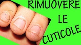 COME RIMUOVERE LE CUTICOLE Sos unghie 9 [upl. by Dede]